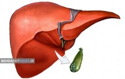 آیا بدون کیسه صفرا می توان زندگی کرد؟